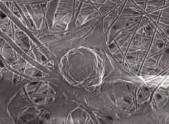 dendritická buňka na nanovláknové membráně (zdroj P. Sláma)